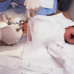 baby boy being cicumcised