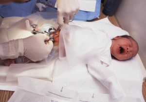 baby boy being cicumcised