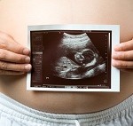 Pregnant woman with ultra sound
