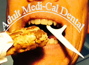 Denti-Cal now offers adult dental services.