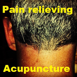 My gray hair camouflages the acupuncture needles in my neck. Dr. Pan, Granite Bay, Ca.