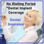 Dental implant insurance