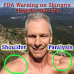 I experienced shoulder paralysis and weakness because of the Shingrix vaccine.