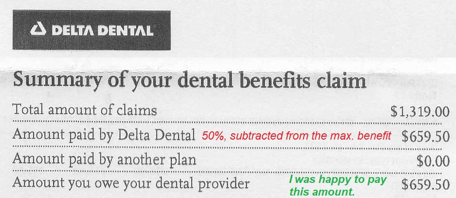 The dental plan covered 50% of the cubic zirconium crown installed in my mouth.